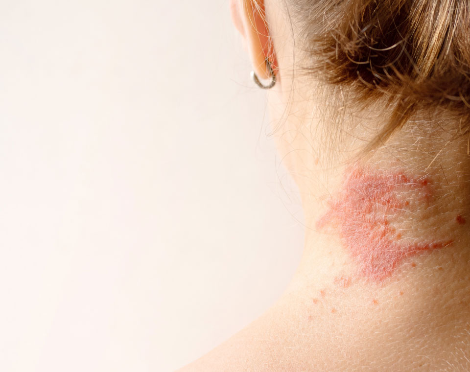 hauterkrankungen_image hauterkrankungen_image